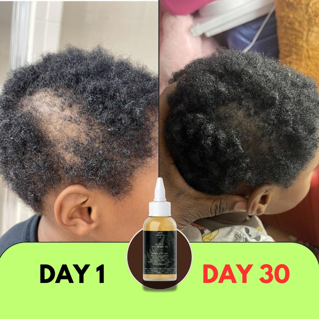 Image of 10 in 1 Hair Growth Oil