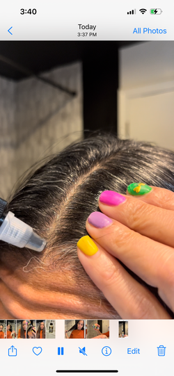 Hair Growth Company