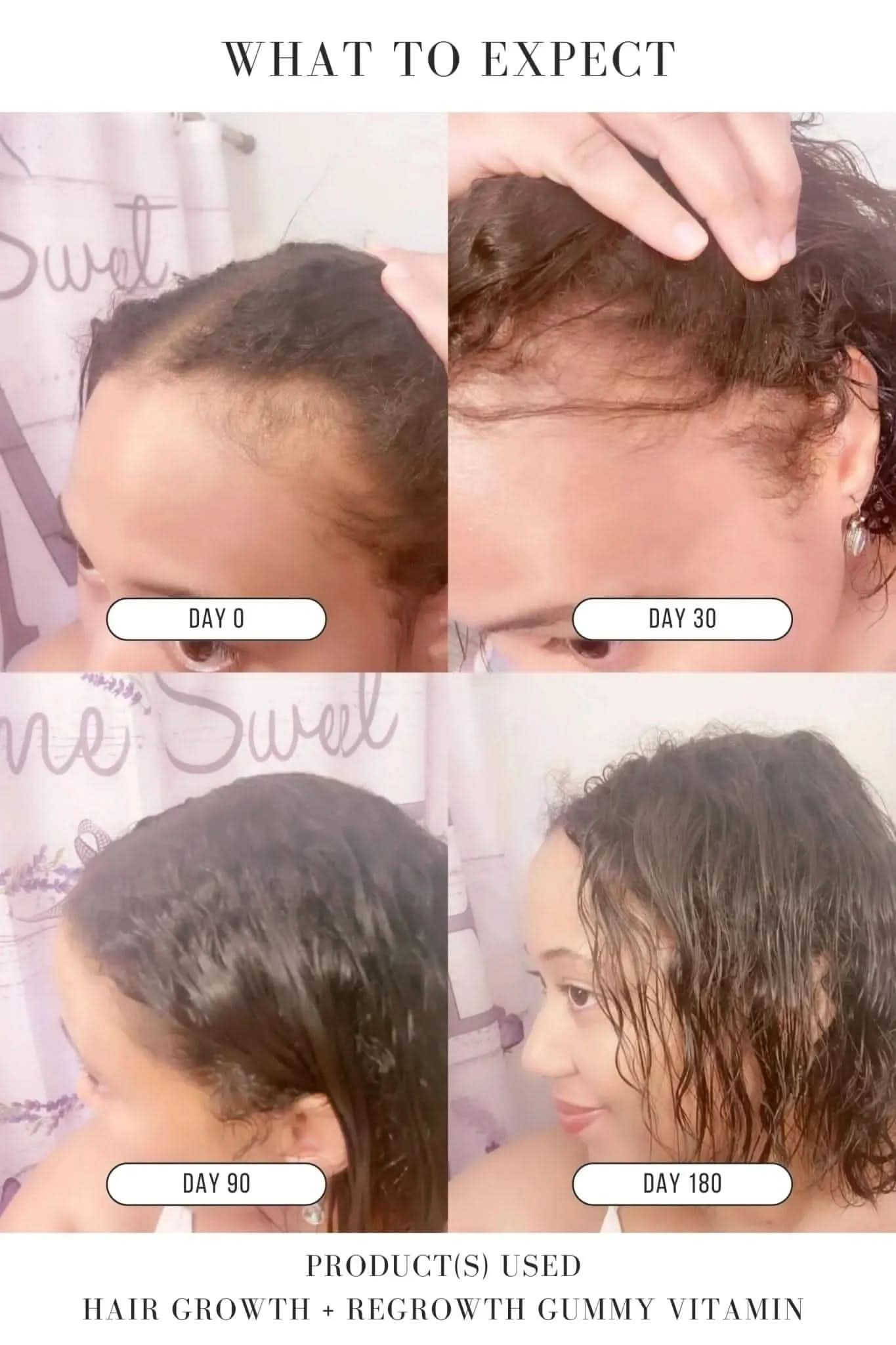 Hair Growth + Regrowth Gummy Vitamin (1-Month Supply)