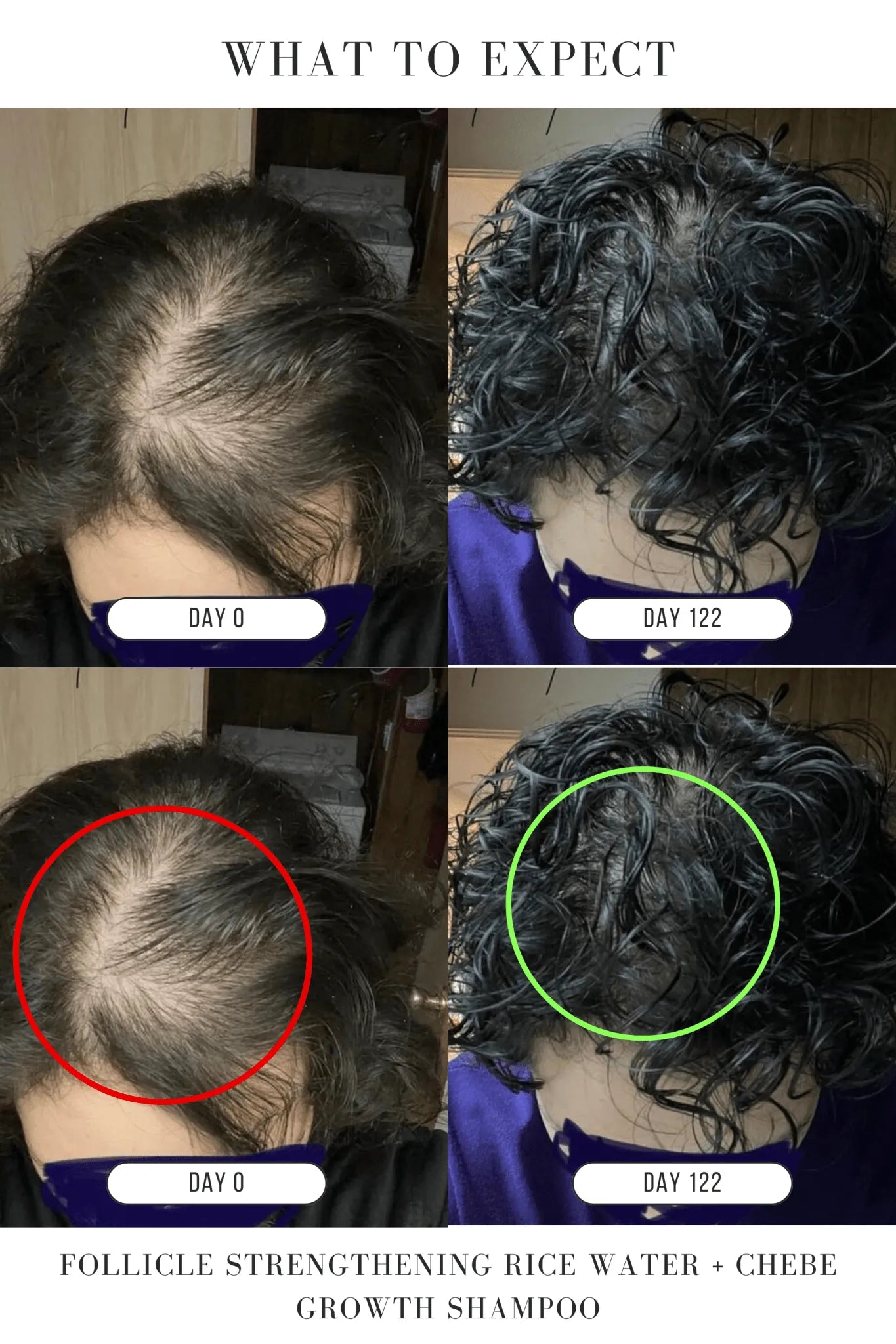 Follicle Strengthening Rice Water + Chebe Growth Shampoo - Hair Growth Co