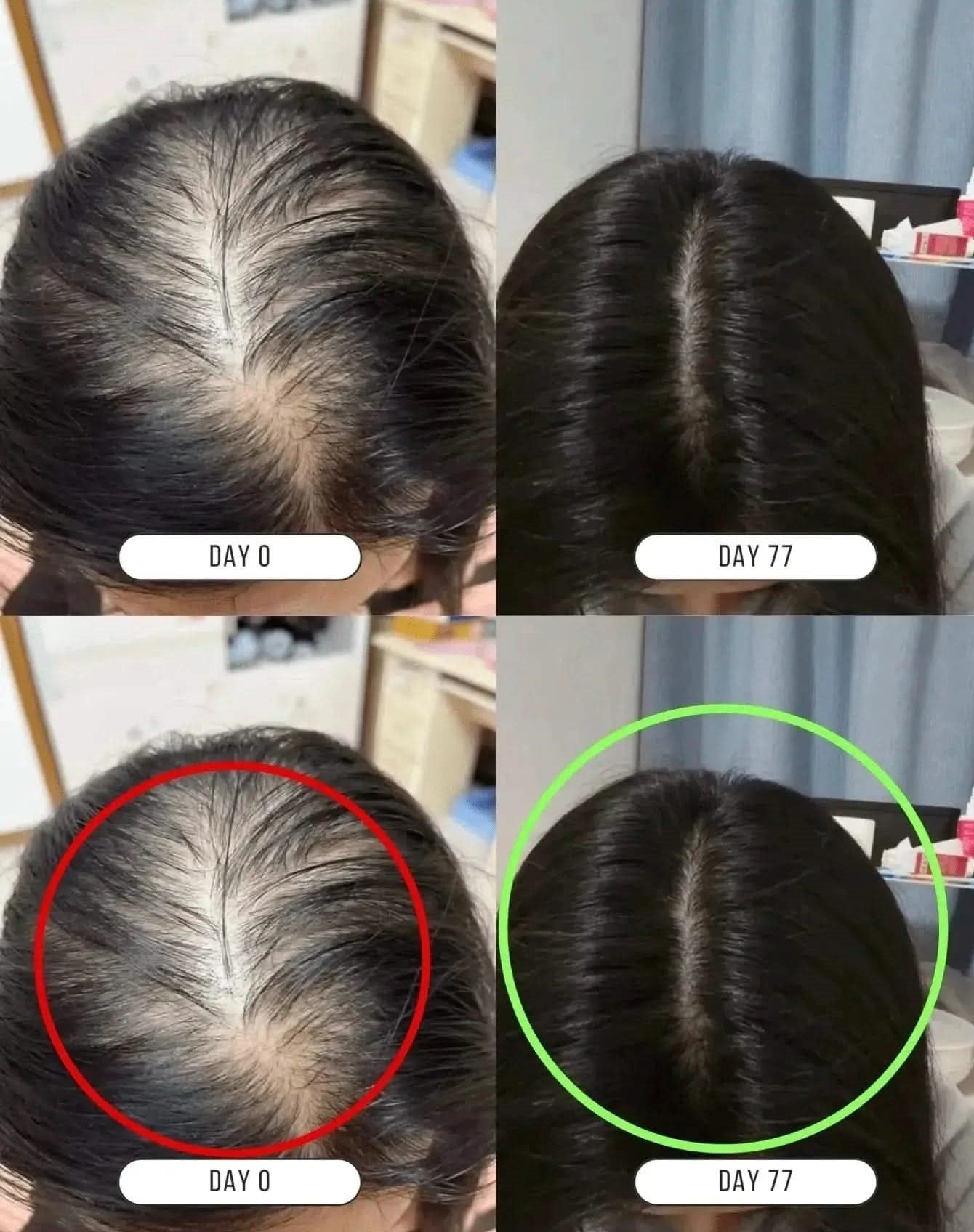 Hair Growth Company