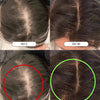 Hair Growth + Regrowth Gummy Vitamin (1 - Month Supply) - Hair Growth Co