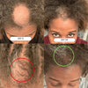Hair Growth + Regrowth Gummy Vitamin (1 - Month Supply) - Hair Growth Co