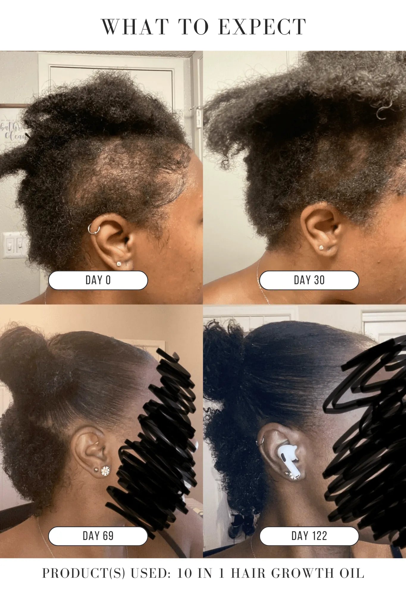 ⭐JUMBO⭐ 10 in 1 Hair Growth Oil (8 oz)(4X the Size!) - Hair Growth Co