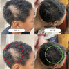 ⭐JUMBO⭐ 10 in 1 Hair Growth Oil (8 oz)(4X the Size!) - Hair Growth Co