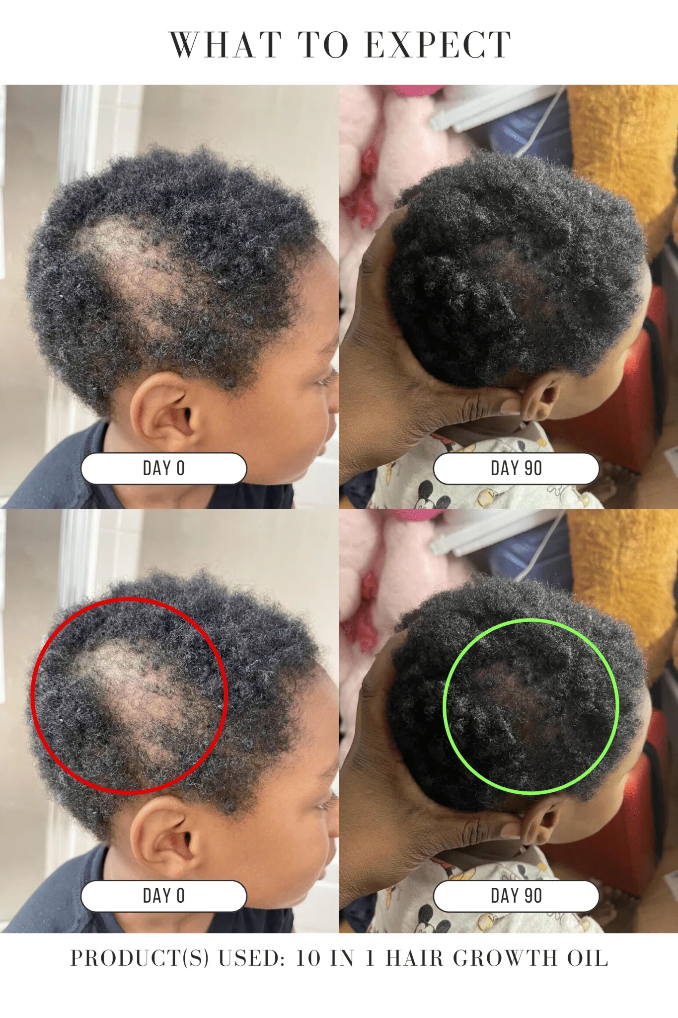 ⭐JUMBO⭐ 10 in 1 Hair Growth Oil (8 oz)(4X the Size!) - Hair Growth Co