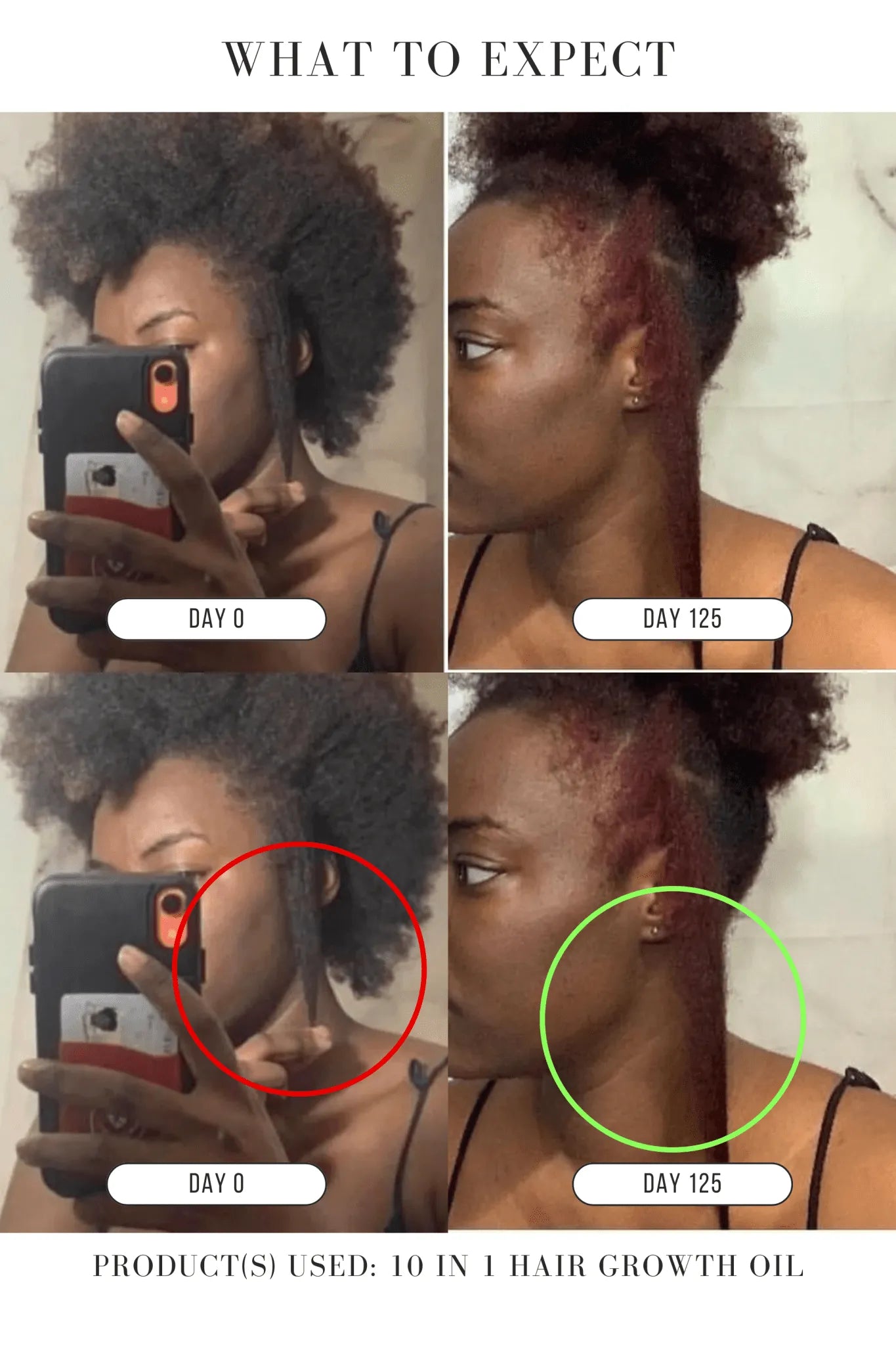 ⭐JUMBO⭐ 10 in 1 Hair Growth Oil (8 oz)(4X the Size!) - Hair Growth Co