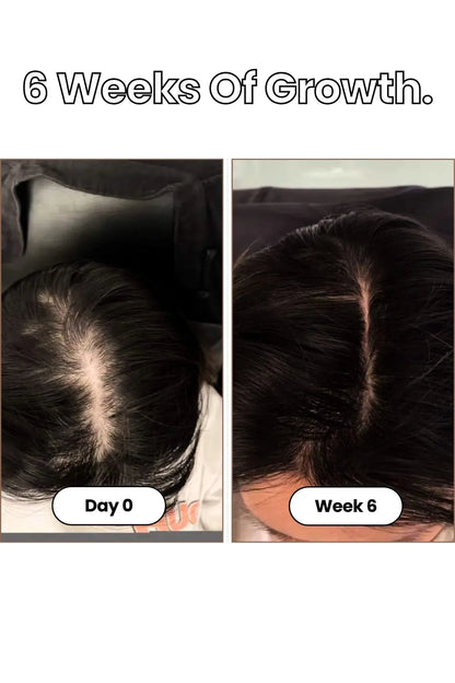 Oil-free 10 in 1 Hair Growth Serum