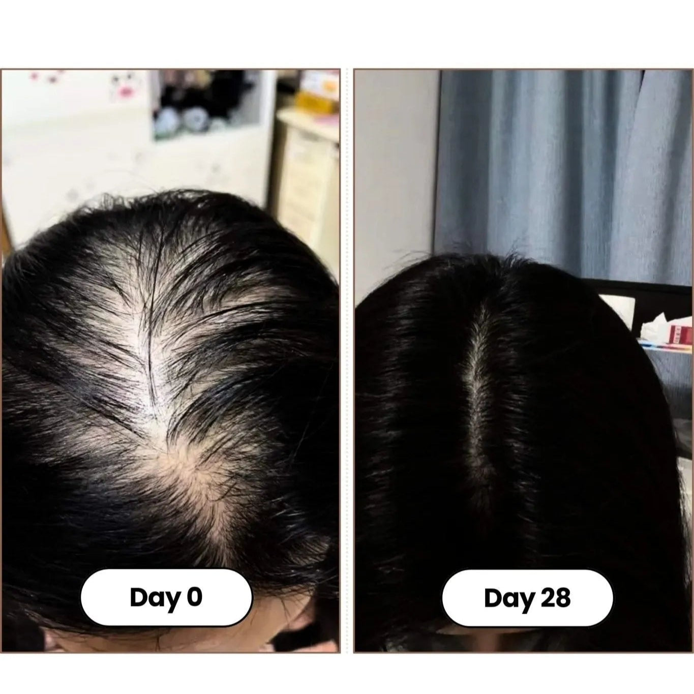 Before and after comparison of hair growth over 28 days.