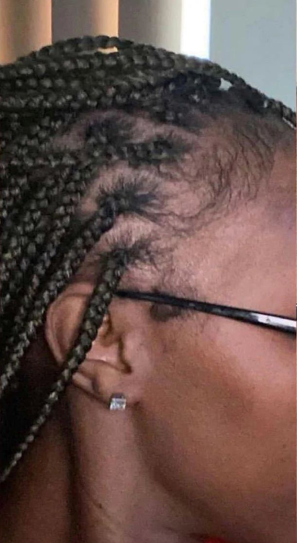 Customer after progress photo