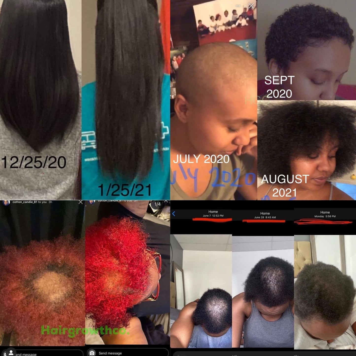 10 in 1 Hair Growth Oil - Hair Growth Co
