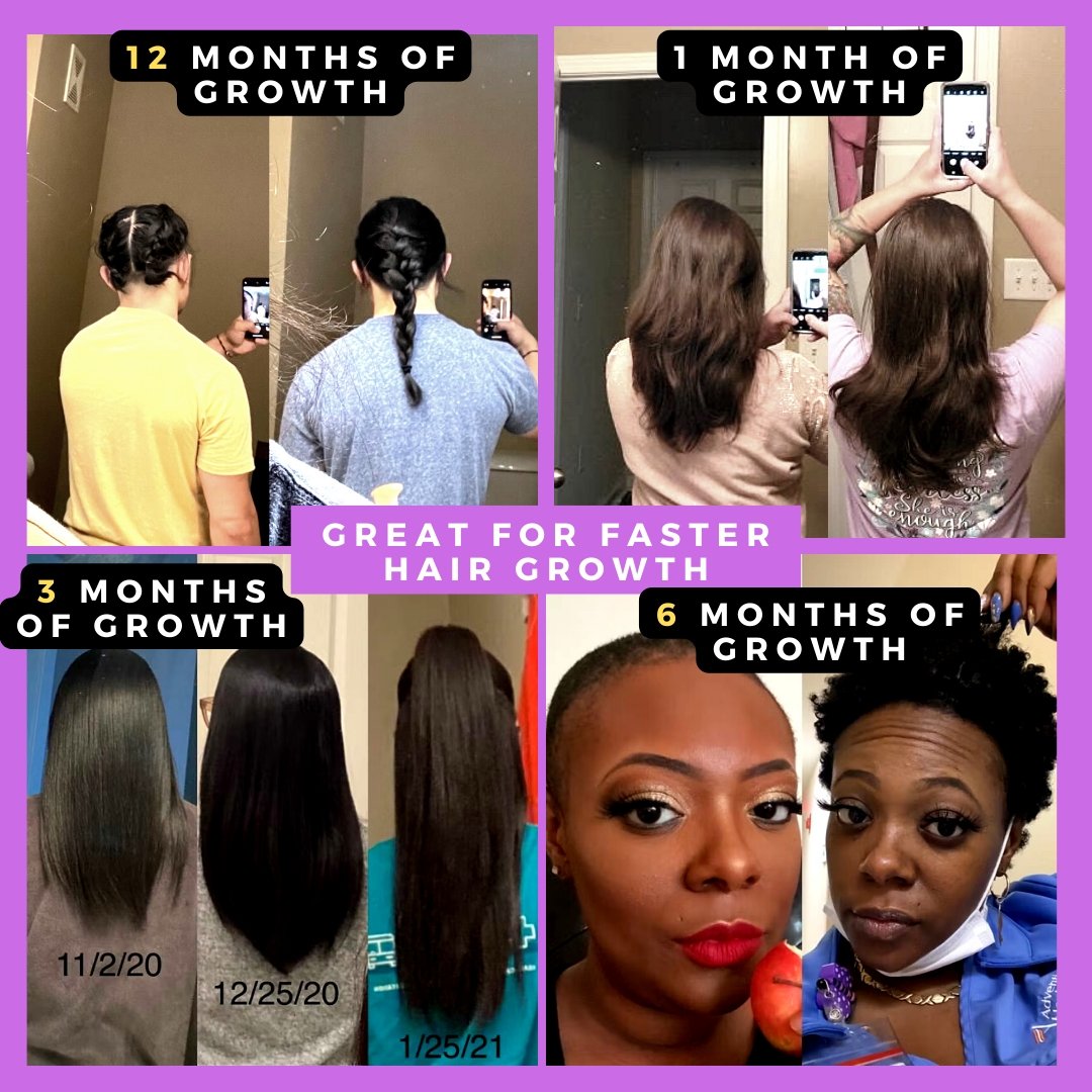 Buy The Hair Regrowth Pack for Stronger Hair - 2 Month Pack | Man Matters