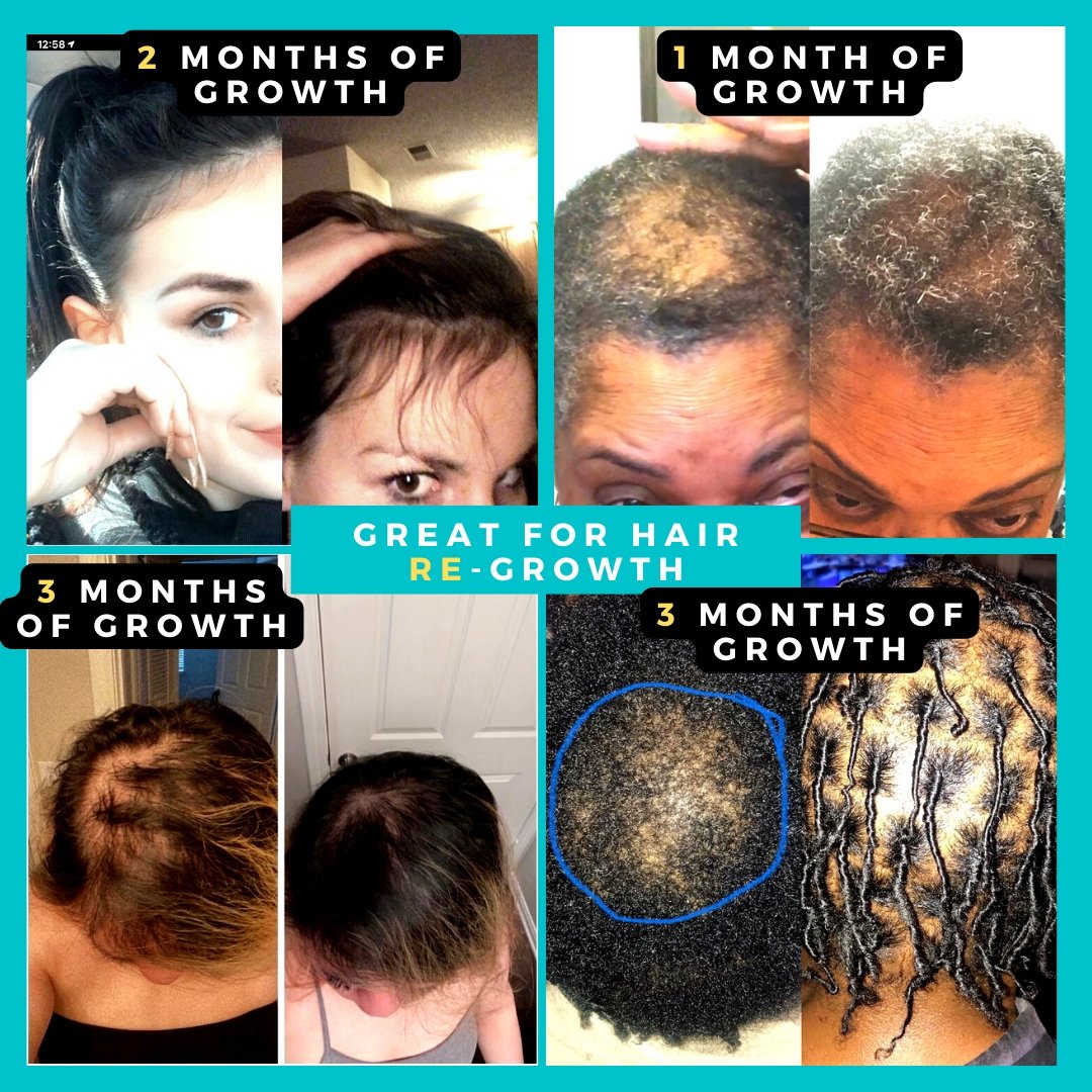 بخاخ نمو الشعر لتقوية فروة الرأس والشعر Rice Water for Hair Growth - H –  Orisdi